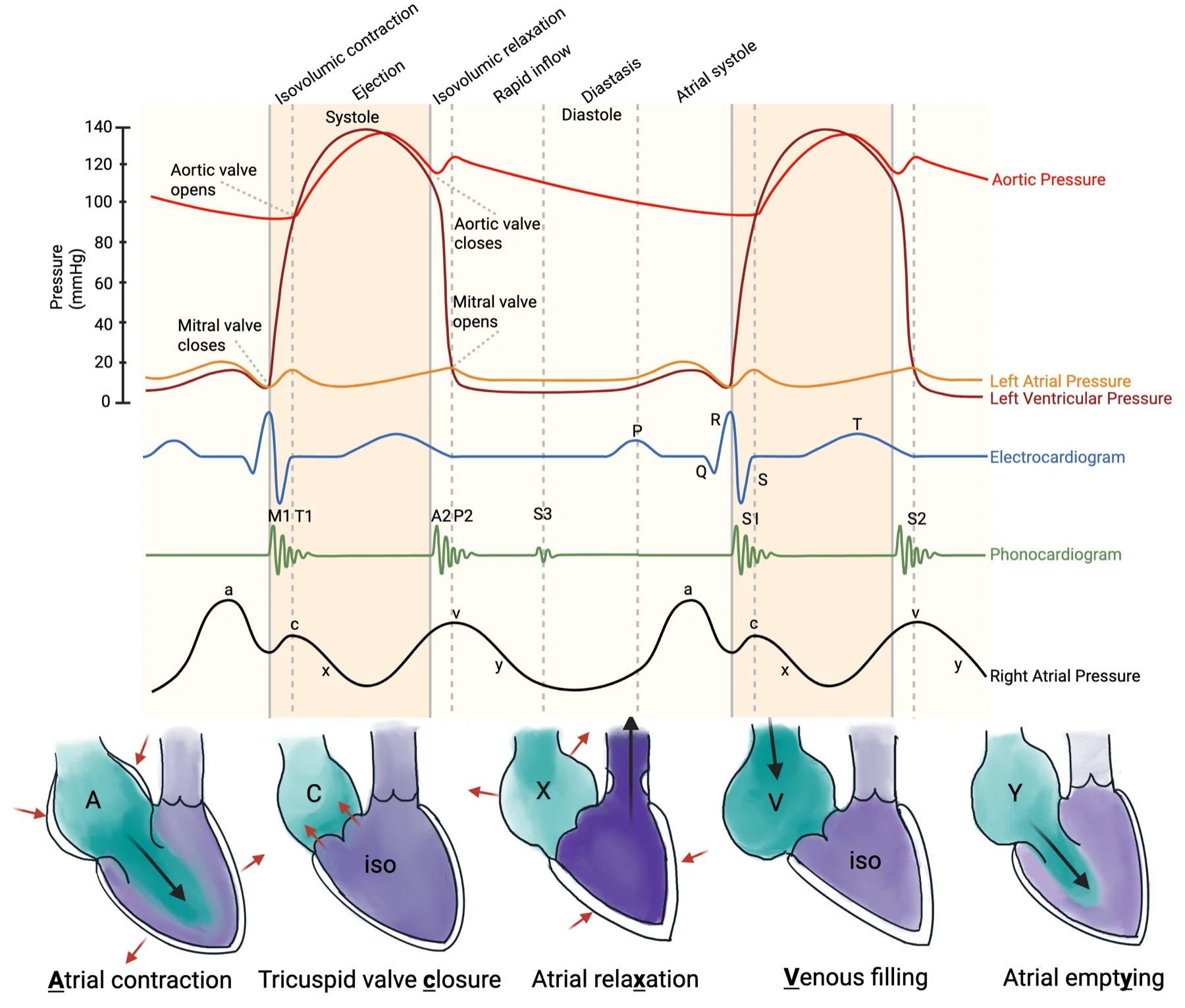 Illustration of the CVP waveform in Normal sinus rhythm